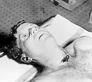 甘迺迪傷勢真實情況，第一顆子彈在他的脖子正中開了一個洞
