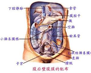 腹膜間皮瘤