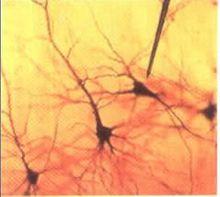 神經元樹突