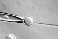 人獸混合胚胎