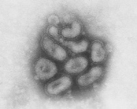 （圖）禽流感病毒