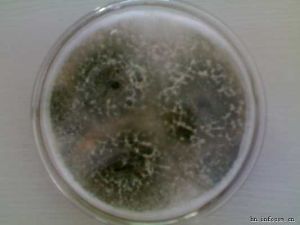 木黴菌
