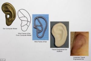 此圖片展示了從電腦建模到最終移植的人造耳培育全過程。