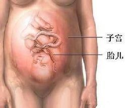 子宮和胎兒