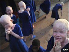 可憐的南非“巫蠱”兒童