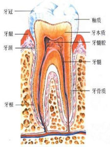 牙髓炎