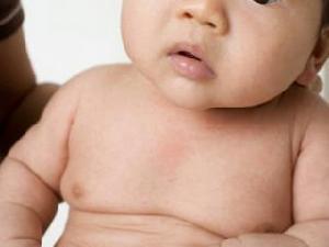 新生兒流行性腹瀉