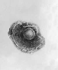 （圖）帶狀皰疹病毒的電鏡負染照片顯示其病毒顆粒周圍被包膜所環繞