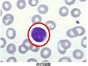 淋巴細胞