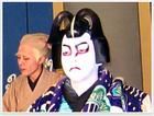 歌舞伎臉譜綜合症