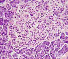 顯微鏡下的胰島 beta 細胞