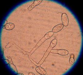 真菌孢子