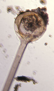圖說： 匍枝根霉孢子散落後之中軸與孢子