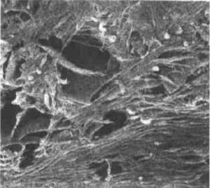 肌成纖維細胞