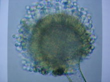 顯微鏡下的黃麴黴菌落