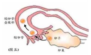 輸卵管結核