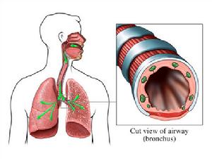 急性氣管支氣管炎