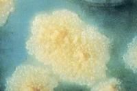 結核桿菌菌落-羅氏培養基