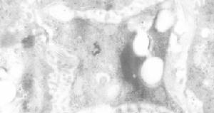 肝星狀細胞