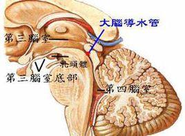 導水管周圍受損