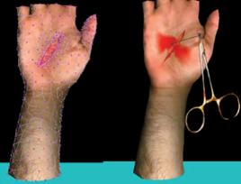 虛擬手術 虛擬手術