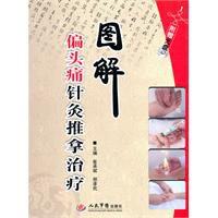 圖解偏頭痛針灸推拿治療 圖解偏頭痛針灸推拿治療