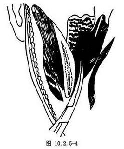 頜下三角膿腫切開引流術 頜下三角膿腫切開引流術