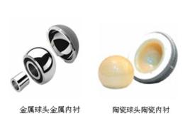 人工髖關節 人工髖關節