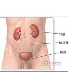 小兒腎積水 小兒腎積水