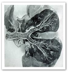 牛網尾線蟲病 牛網尾線蟲病