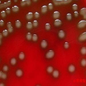 老年人陽性桿菌肺炎