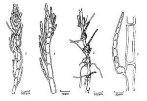 蠕蟲凝對絲藻 蠕蟲凝對絲藻
