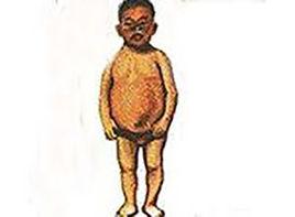 身體下部短於上部 身體下部短於上部