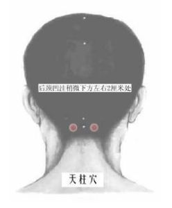 天柱穴 天柱穴