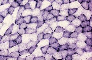 嗜檸檬酸明串珠菌 嗜檸檬酸明串珠菌