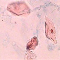 鱗狀上皮細胞