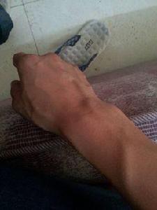 青筋暴露 青筋暴露