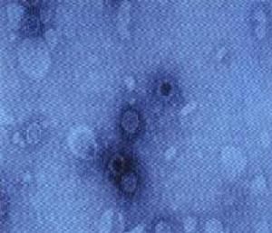 電鏡下的隱孢子蟲