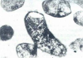 單細胞蛋白 單細胞蛋白