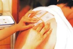 天灸療法 天灸療法