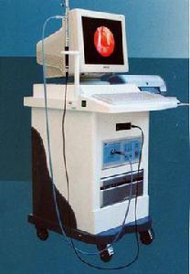 內窺式可視人流 內窺式可視人流