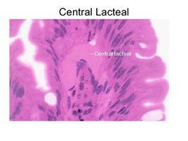 中央乳糜管 中央乳糜管