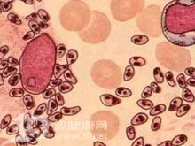 利什曼原蟲病 利什曼原蟲病