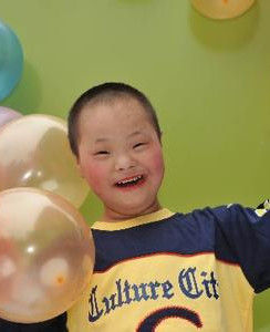 小兒唐氏綜合徵 小兒唐氏綜合徵