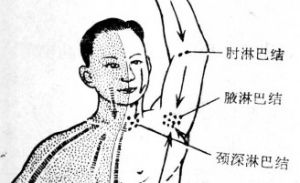 頸後淋巴結 頸後淋巴結