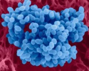 葡萄球菌感染 葡萄球菌感染