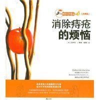消除痔瘡的煩惱 消除痔瘡的煩惱