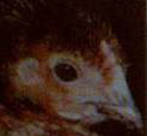 雞膽鹼缺乏症 雞膽鹼缺乏症