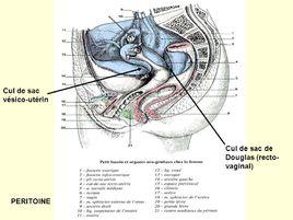 直腸子宮陷凹 直腸子宮陷凹