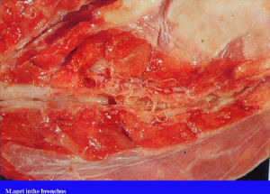牛肺線蟲病 牛肺線蟲病